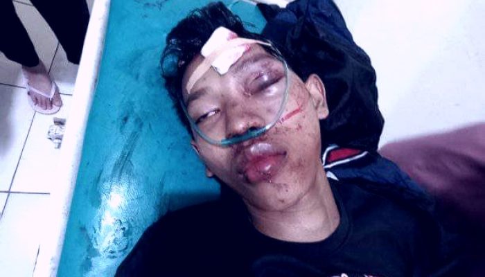 Kecelakaan Maut di Indralaya Ogan Ilir, Korban Tanpa Identitas dalam Kondisi Kritis, Mohon Dibantu Carikan Keluarganya: Kasihan!